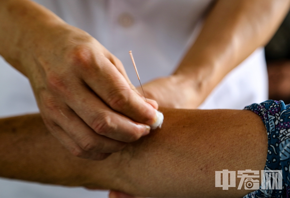 經過簡單的準備，韓洪光取出銀針，尋找著穴位。隨著幾枚銀針悄然沒入穴位，村民緊蹙的眉頭漸漸舒展，一股微暖的酸脹感沿著經絡蔓延。 李結義 攝
